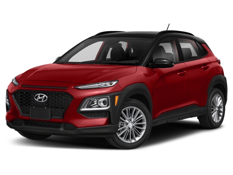 2018 Hyundai Kona 2.0L Luxury AWD Exterior Shot 1