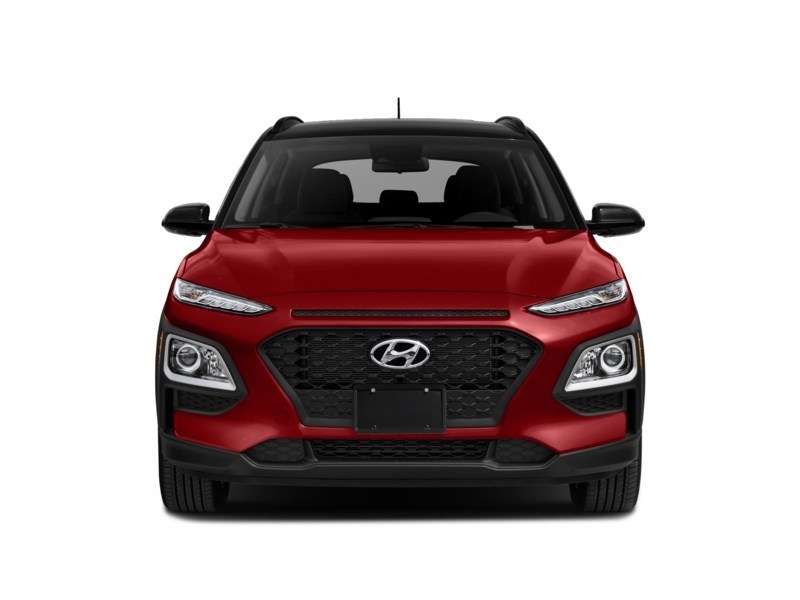 2018 Hyundai Kona 2.0L Luxury AWD Exterior Shot 5