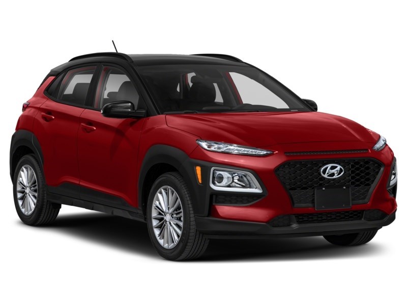 2018 Hyundai Kona 2.0L Luxury AWD Exterior Shot 8